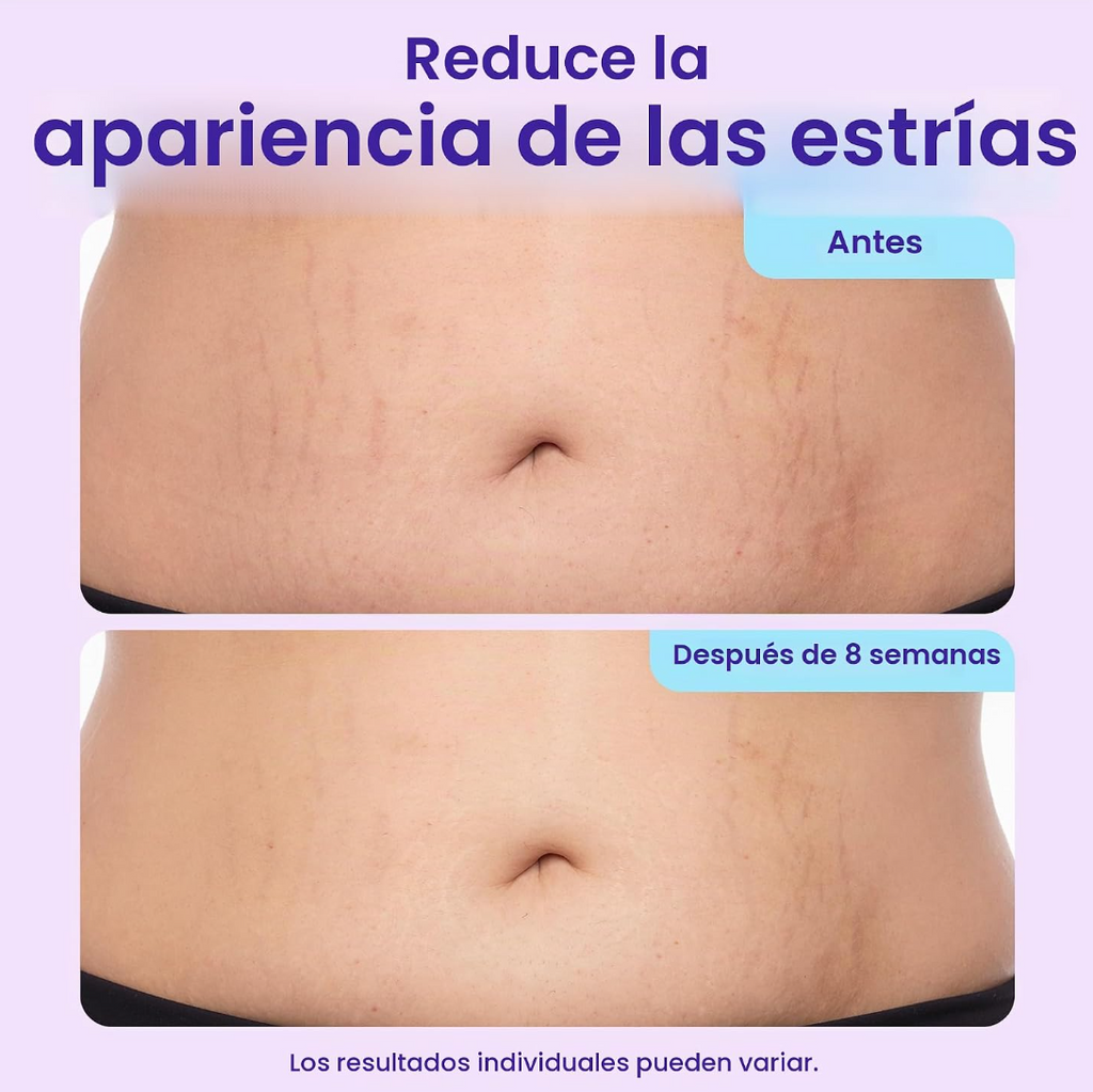 Crema Para Firmeza Abdomen Gopure