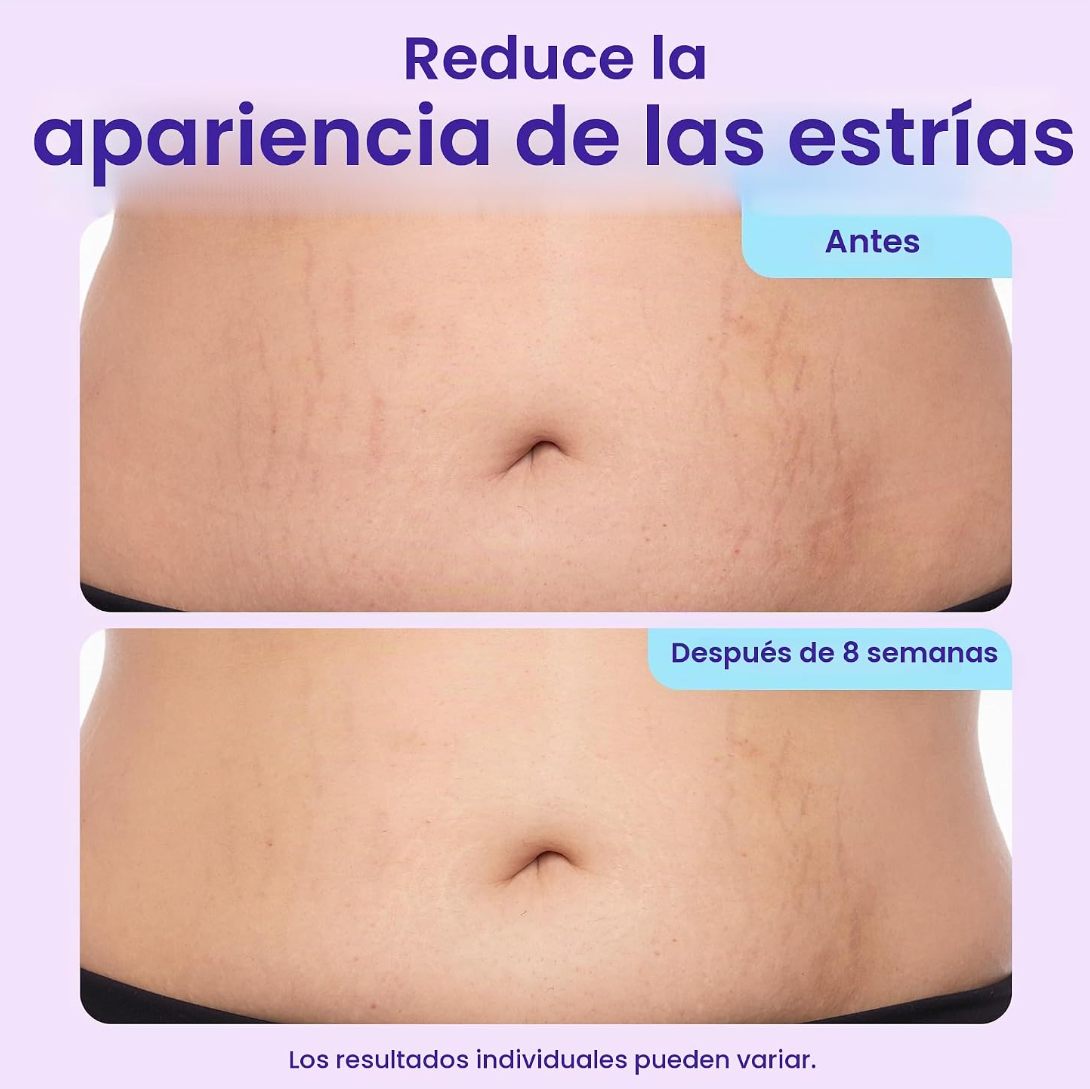 Crema Para Firmeza Abdomen Gopure