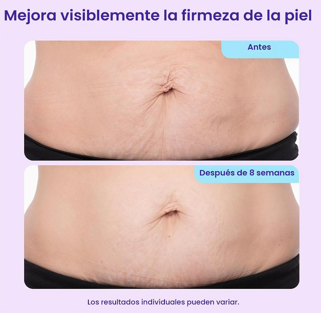 Crema Para Firmeza Abdomen Gopure