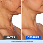 Crema Gopure Para Cuello